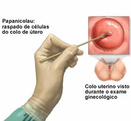 Citologia Oncótica / Papanicolau